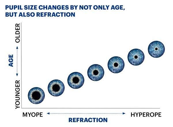 Relationship between age, pupil size, and refraction